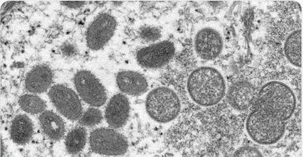 博瑞生物推出猴痘病毒数字PCR与荧光PCR检测试剂盒，助力科学战“痘”